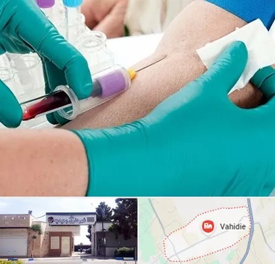 آزمایشگاه در منزل در وحیدیه شهریار
