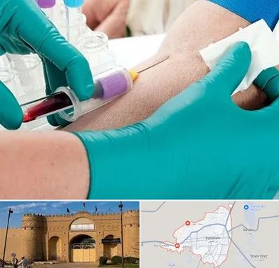 آزمایشگاه در منزل در ایرانشهر