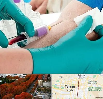 آزمایشگاه در منزل در ولیعصر 