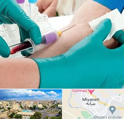 آزمایشگاه در منزل در میانه