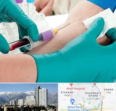 آزمایشگاه در منزل در شهرک غرب 