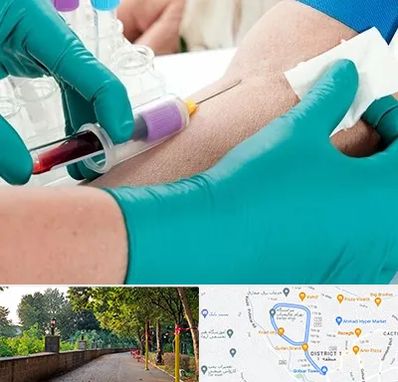 آزمایشگاه در منزل در بلوار گیلان رشت