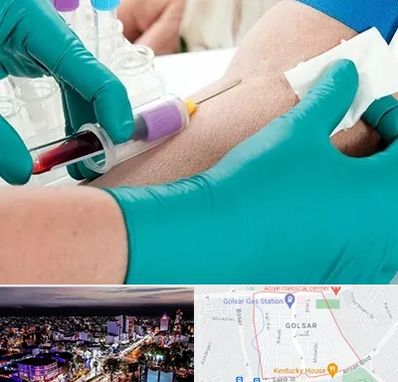 آزمایشگاه در منزل در گلسار رشت 