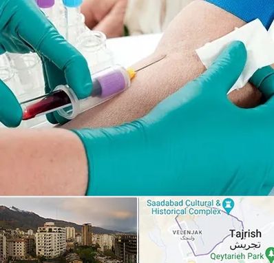 آزمایشگاه در منزل در زعفرانیه 