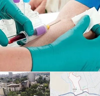 آزمایشگاه در منزل در اوین