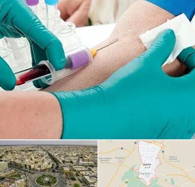 آزمایشگاه در منزل در قزوین