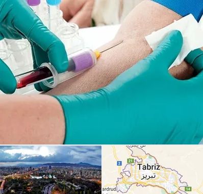 آزمایشگاه در منزل در تبریز