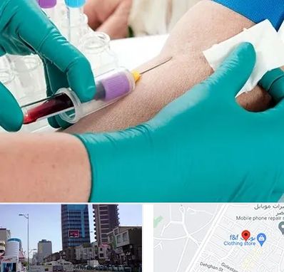 آزمایشگاه در منزل در چهارراه طالقانی کرج