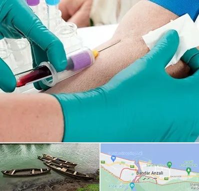 آزمایشگاه در منزل در بندر انزلی