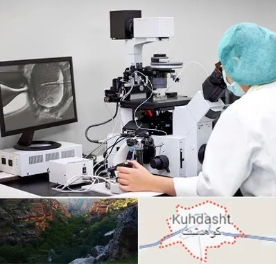 آزمایشگاه اسپرموگرام در کوهدشت