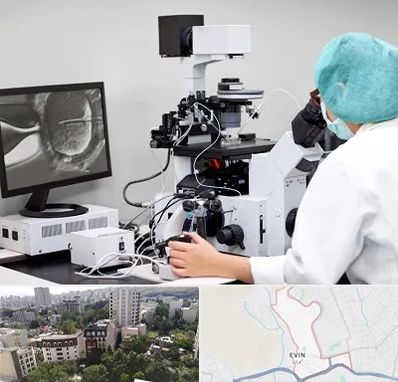 آزمایشگاه اسپرموگرام در اوین