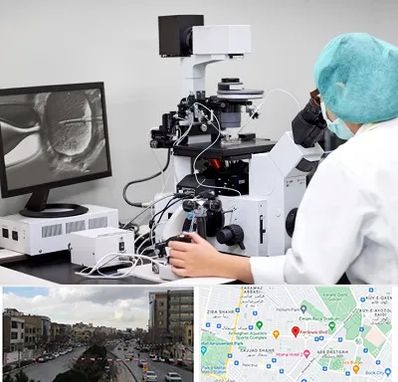 آزمایشگاه اسپرموگرام در بلوار فردوسی مشهد