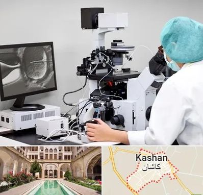 آزمایشگاه اسپرموگرام در کاشان