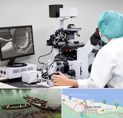 آزمایشگاه اسپرموگرام در بندر انزلی