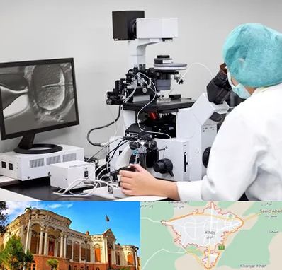 آزمایشگاه اسپرموگرام در خوی