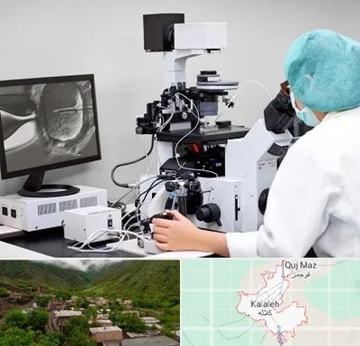 آزمایشگاه اسپرموگرام در کلاله