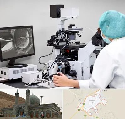 آزمایشگاه اسپرموگرام در شهرضا