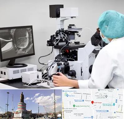 آزمایشگاه اسپرموگرام در کارگر جنوبی 