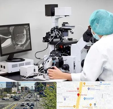 آزمایشگاه اسپرموگرام در ستاری 