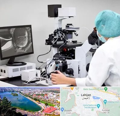 آزمایشگاه اسپرموگرام در لاهیجان