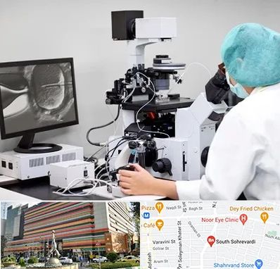 آزمایشگاه اسپرموگرام در سهروردی 