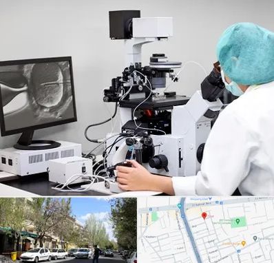 آزمایشگاه اسپرموگرام در کوی فیروز تبریز