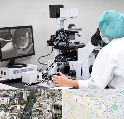 آزمایشگاه اسپرموگرام در منطقه 18 تهران 