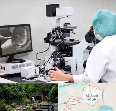 آزمایشگاه اسپرموگرام در علی آباد کتول