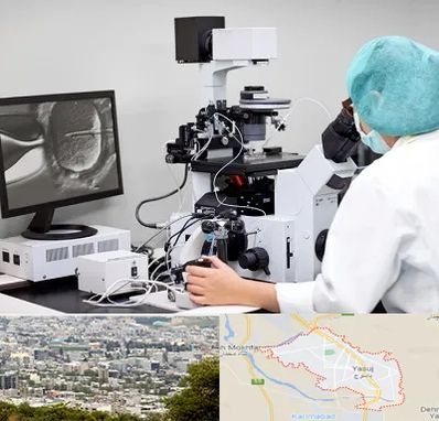 آزمایشگاه اسپرموگرام در یاسوج