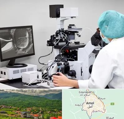 آزمایشگاه اسپرموگرام در آمل
