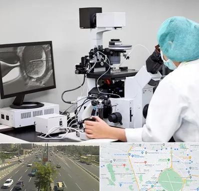 آزمایشگاه اسپرموگرام در منطقه 17 تهران 