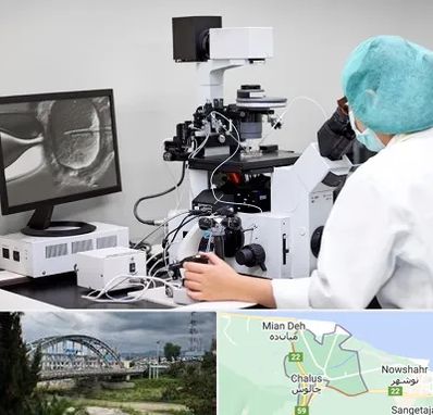 آزمایشگاه اسپرموگرام در چالوس