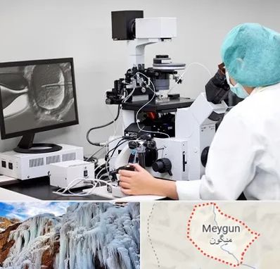 آزمایشگاه اسپرموگرام در میگون