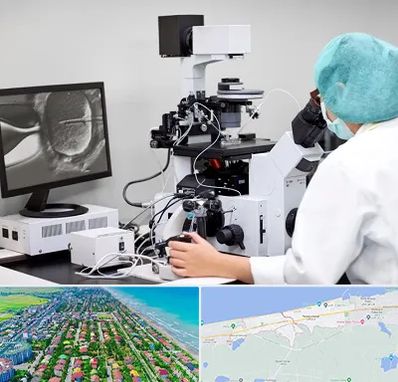 آزمایشگاه اسپرموگرام در فریدونکنار