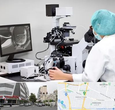 آزمایشگاه اسپرموگرام در بلوار فردوس 