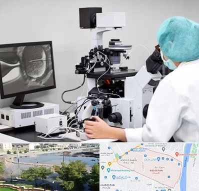 آزمایشگاه اسپرموگرام در گلستان اهواز