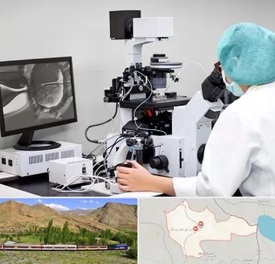 آزمایشگاه اسپرموگرام در خاش