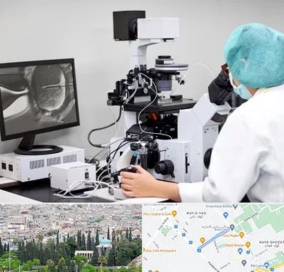 آزمایشگاه اسپرموگرام در محلاتی شیراز