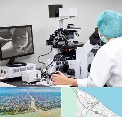 آزمایشگاه اسپرموگرام در تنکابن