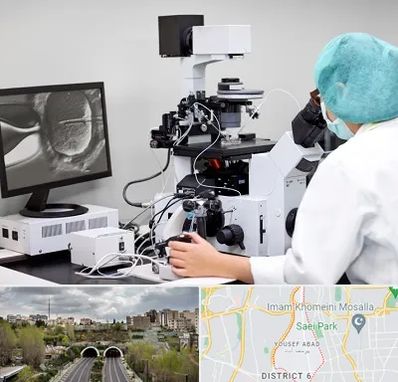 آزمایشگاه اسپرموگرام در یوسف آباد 