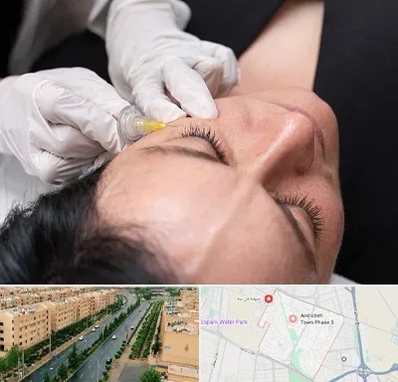 کربوکسی تراپی در فاز سه اندیشه