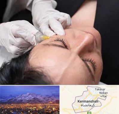 کربوکسی تراپی در کرمانشاه