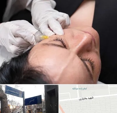 کربوکسی تراپی در سی متری جی