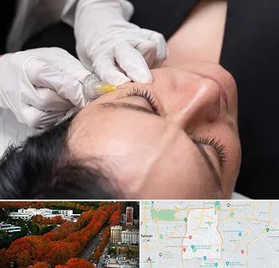 کربوکسی تراپی در منطقه 6 تهران 