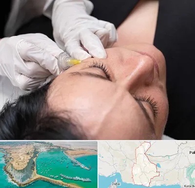کربوکسی تراپی در سیستان و بلوچستان