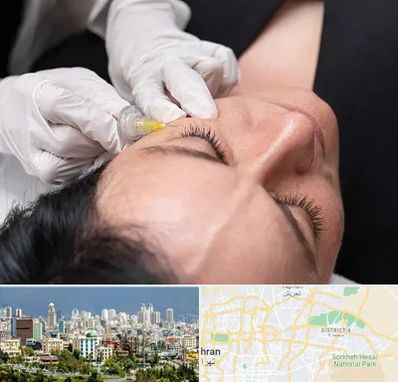 کربوکسی تراپی در شرق تهران 