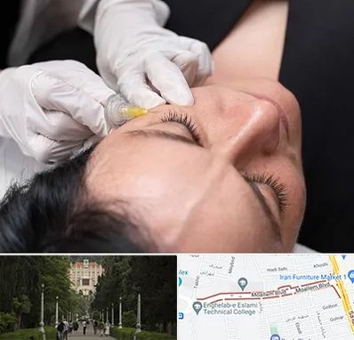 کربوکسی تراپی در بلوار معلم رشت 