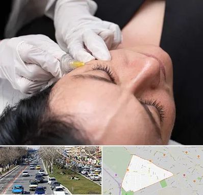 کربوکسی تراپی در احمدآباد مشهد 