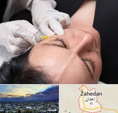 کربوکسی تراپی در زاهدان