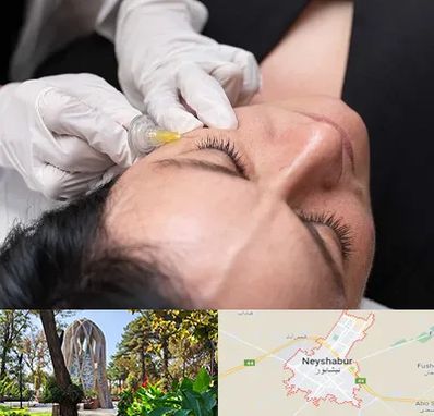 کربوکسی تراپی در نیشابور